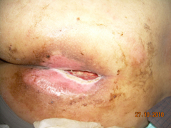 �촯Ȭ����ͼƬ