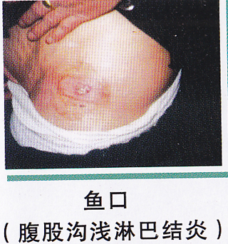 ��ŧ�Լ�����ͼƬ