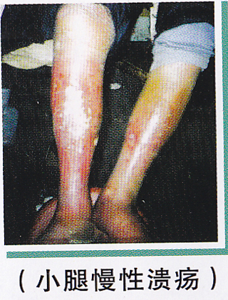 ��ŧ�Լ�����ͼƬ