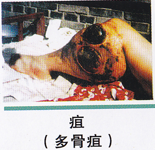 ��ŧ�Լ�����ͼƬ