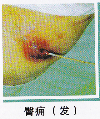 ��ŧ�Լ�����ͼƬ