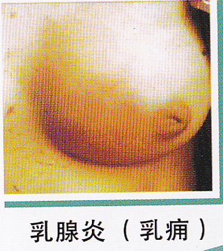 ��ŧ�Լ�����ͼƬ