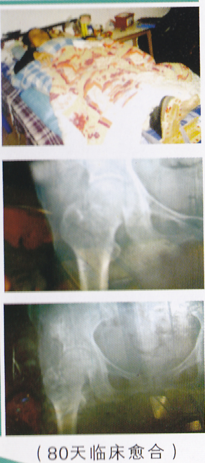 �����˹ɹǾ����۵�ͼƬ