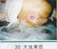 ��ɫ���ƾ޴��촯��ͼƬ