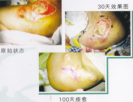 ��ɫ�����촯��ͼƬ