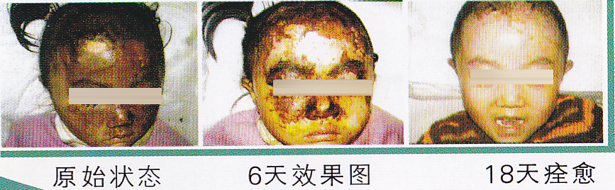 ������ͼƬ