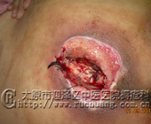 лĳ��Ů��56�꣬��β������7.2cm��7.5cm����5.5cm�촯���Ͳ���