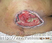 ��ĳ���У�56�꣬��β������9.5cm��10.2cm�촯���Ͳ���