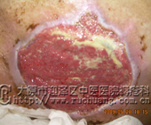 ֣ĳ �� 78�� ��β��12.2cm��11.7cm�촯���Ͳ���