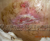 ֣ĳ �� 78�� ��β��12.2cm��11.7cm�촯���Ͳ���