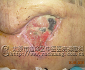 ��ĳ��Ů��76�� ��β������17.5cm��18.2cm�촯���Ͳ���