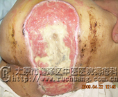 ��ĳ��Ů��80�꣬�촯���Ͳ���