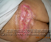 ��ĳ��Ů��80�꣬�촯���Ͳ���