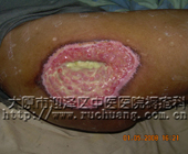 ��ĳ��Ů��78�꣬�Ҳ��Źؽ�����촯�����촯���Ͳ���