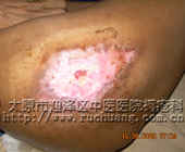 ��ĳ��Ů��78�꣬�Ҳ��Źؽ�����촯�����촯���Ͳ���