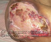 ��ĳ���У�32�꣬����Źؽ�23.4cm��13.3cm���Ҳ��Źؽ�9.5cm��27cm�޴��촯���Ͳ���