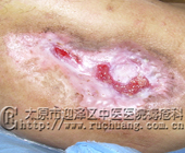 ��ĳ���У�32�꣬����Źؽ�23.4cm��13.3cm���Ҳ��Źؽ�9.5cm��27cm�޴��촯���Ͳ���