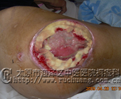 ��ĳ���У�53�꣬��׵��9���۰��̱�촯���Ͳ���