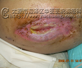 ��ĳ���У�53�꣬��׵��9���۰��̱�촯���Ͳ���